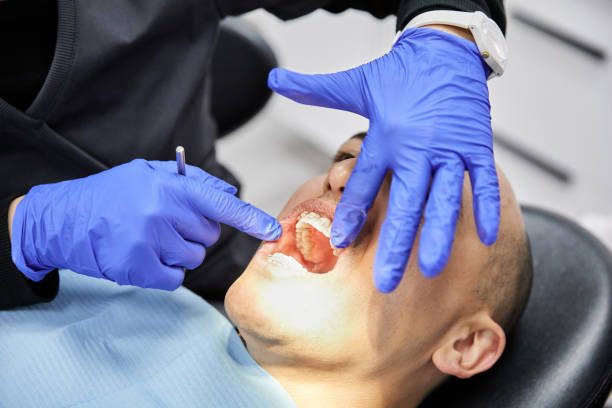 Emergency Dental Filling Replacement in MT